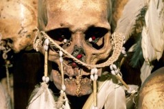 Genetic Mutation blocks Prion Disease