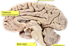 Prions & Your Brain