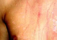 Jack's Scratches